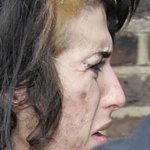 Amy Winehouse Peau