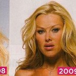 Angie Secret Story 3 Avant Apres Chirurgie