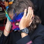 Prince Jackson Vitiligo