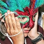 Prince Jackson Vitiligo 1