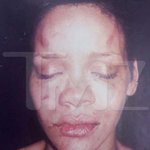 Rihanna Agressee Photo