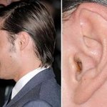 Zac Efron Sale Oreille Cerumen